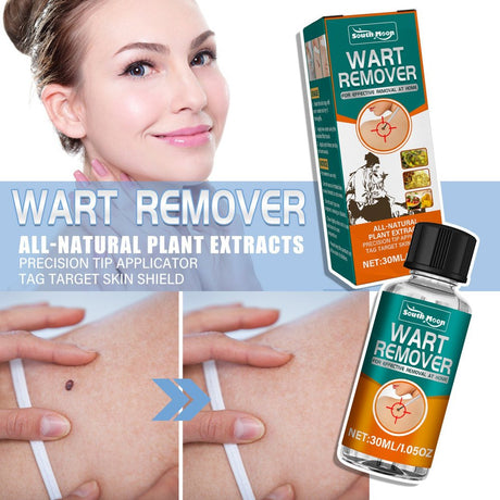 2 Pack Wart and Tag Removal for Body Plantar Genitals,Gentle Removal of HPV Tags for Skin