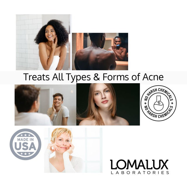 Loma Lux Laboratories - Acne Pill Healthy Skin Formula - 60 Quick Dissolve Tablets