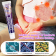 AURORA TRADE 20G Vaginal Ointment Antibacterial Relieve Itching Skin-Care Women Private Parts Dermatitis Treatment for Female