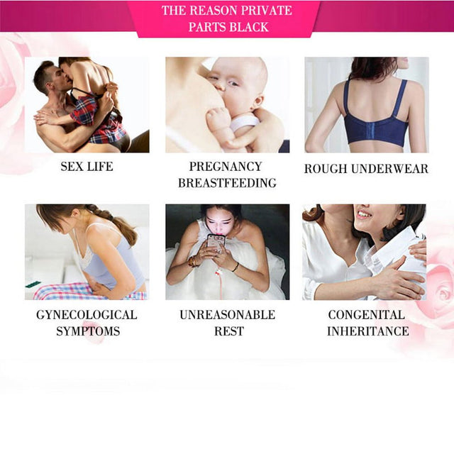 30G Women Private Part Pink Vaginal Lips Underarm Cream Dark Nipple Brighten Skin Care Body Cream