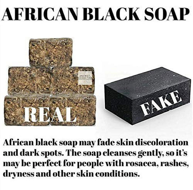 Premium African Black Soap - 1Lb Raw Organic Soap for Acne, Dry Skin, Rashes, Scar Removal, Face & Body Wash Bulk