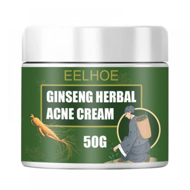 Ginseng Herb Anti-Acne Treatment Cream, Acne Removal, Fighting Breakouts, Spots, Cystic Acne with Natural Ingredients and Advanced Herbal Formula,50G