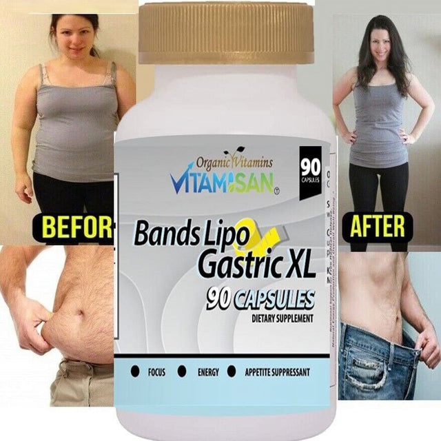 Bands Lipo Gastric XL Pills to Lose Weight Fast Appetite Suppressant Slimming Burn Fat 90 Capsules