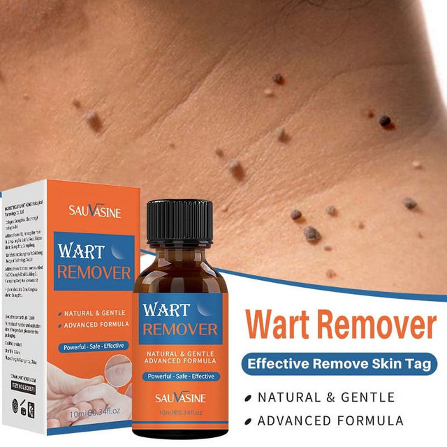 Wart Remover,Gentle Wart Remover, Maximum Strength, Painlessly Removes Plantar Neck, Hands, Back, Advanced Liquid Gel Formula