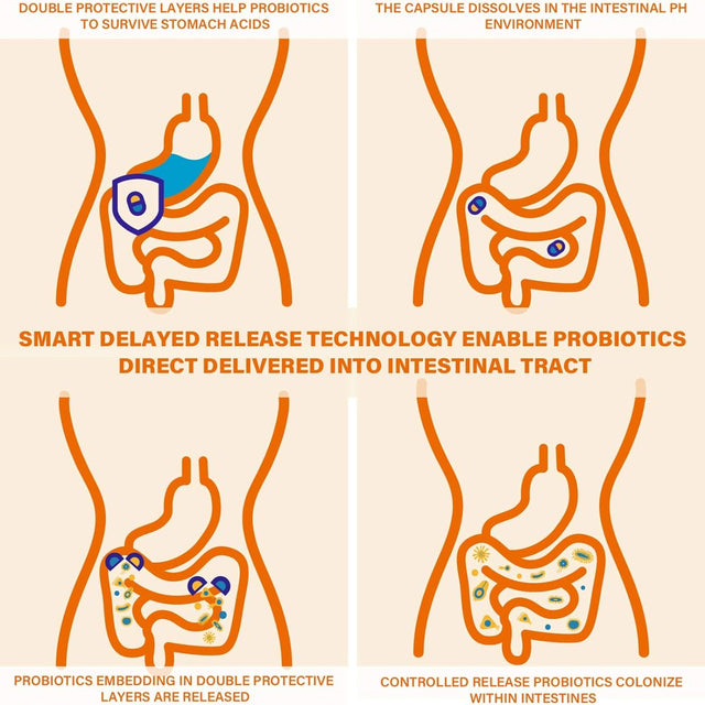 Prebiotics & Probiotics for Women and Men - Probiotics 60 Billion, 19 Strains Acidophilus Probiotic Supplement for Gut Digestive, Immune, Feminine Health, Shelf Stable Soy & Dairy Free | 60 Vegan Caps