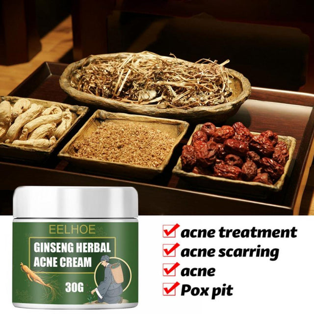 Ginseng Herb Anti-Acne Treatment Cream, Acne Removal, Fighting Breakouts, Spots, Cystic Acne with Natural Ingredients and Advanced Herbal Formula,50G