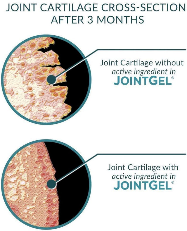 Joint Gel Formula from Purity Products - Bioactive Collagen Peptides + MSM - Supports Joint Function + Flexibility While Fortifying Joint Cartilage - Dual Action, Berry Flavored Powder - 30 Day Supply