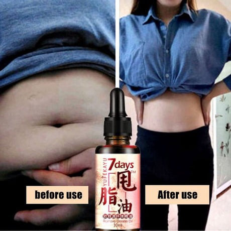 Body Fat Loss Massage Essential Oil Weight Loss Promote Fat Burn Thin Waist Skin Care Treatment 10Ml