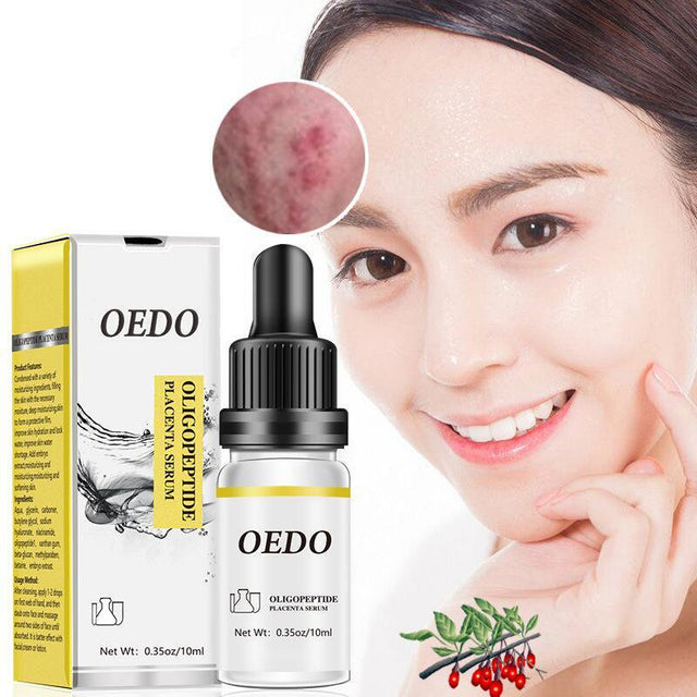 2 Pack 30% Vitamin C Serum with Hyaluronic Acid & VE for Face, Neck and Eye Treatment Serums, anti Aging Facial Serum