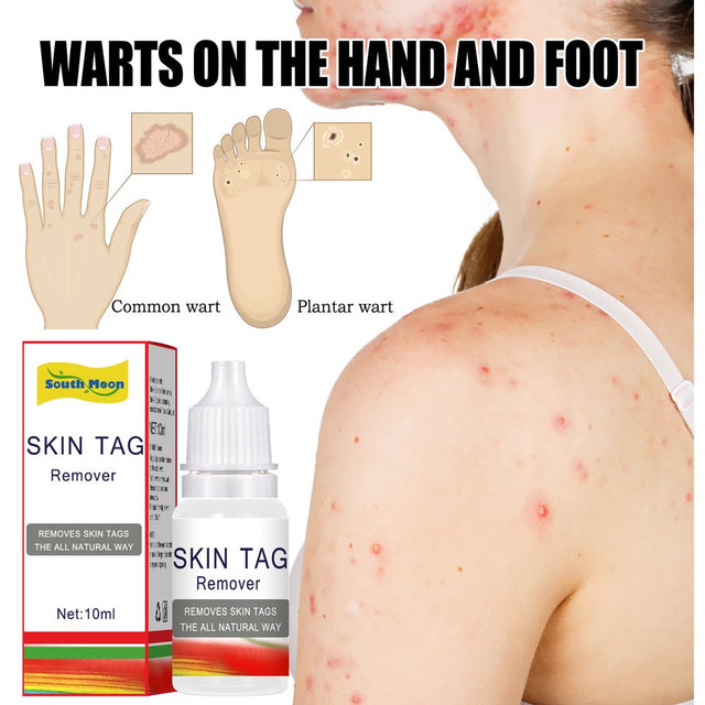 Herbal Gentle to Wart, Painless Removal of Tag and HPV, Rejuvenate Skin and Body