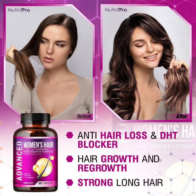 Hair Growth Vitamins for Women - Hair Vitamins for Hair Loss for Women .Regrow & Regrowth Hair Supplement with DHT Blocker,Biotin & Saw Palmetto for Women.Volumize,Thicker,Longer Hair.