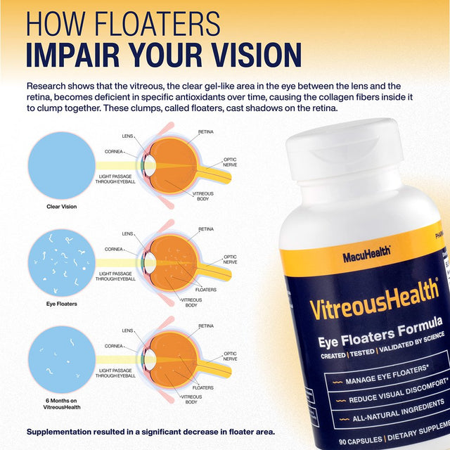 Macuhealth Vitreoushealth Evidence-Based Eye Supplement for Floaters - 90 Eye Vitamin Capsules, Eye Supplements for Adults, Reduce Eye Floater Symptoms, Eye Health Vitamins - 3 Month Supply