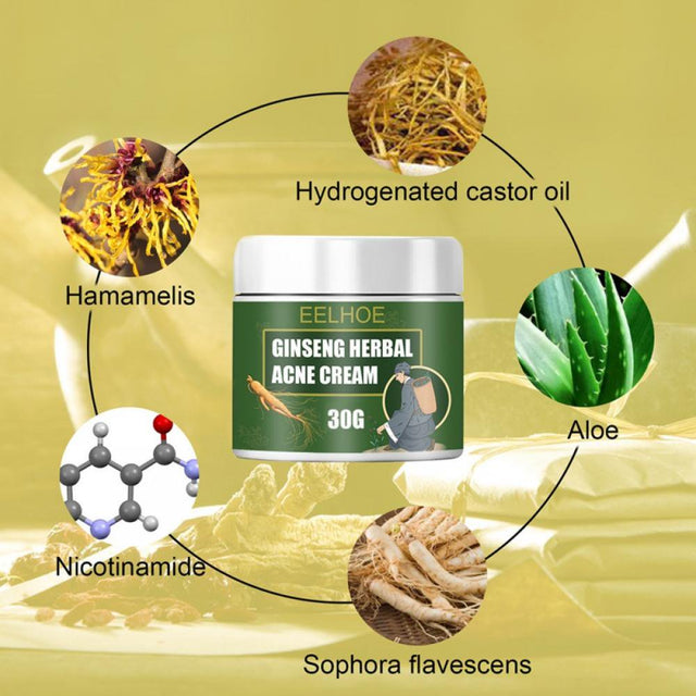 Ginseng Herb Anti-Acne Treatment Cream, Acne Removal, Fighting Breakouts, Spots, Cystic Acne with Natural Ingredients and Advanced Herbal Formula,50G