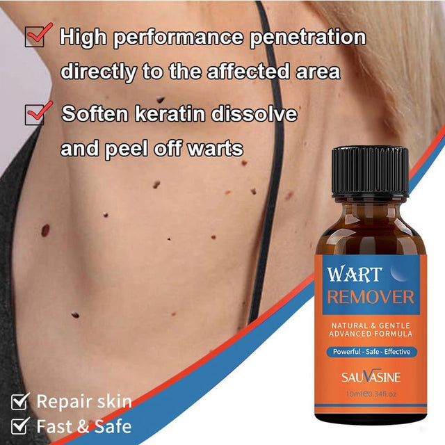 Wart Remover,Gentle Wart Remover, Maximum Strength, Painlessly Removes Plantar Neck, Hands, Back, Advanced Liquid Gel Formula