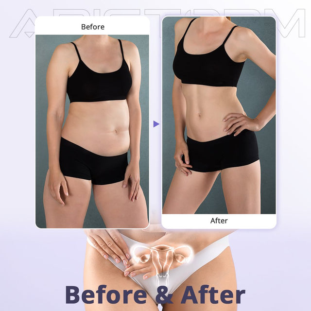 Aristorm LED Laser Lipo Fat Burning Cellulite Removal Body Sculpting Machine, Effective Home Beauty Treatment for Men and Women