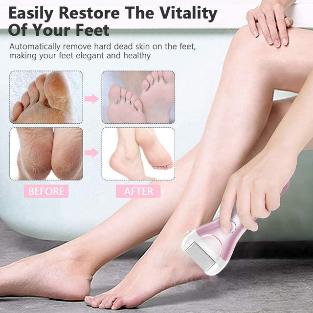 Electric Callus Remover - Rechargeable Foot File Callus Shaver Hard Skin Remover Pedicure Tools with 3 Roller Heads, for Cracked Heels Calluses and Dead Skin, 2 Speed, Battery Display (Pink)