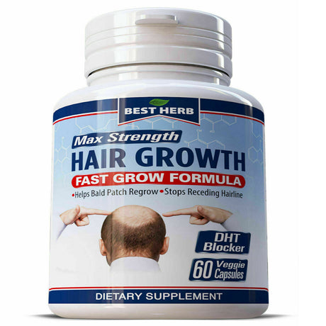 Stop Hair Loss Supplement with DHT Blocker - Stimulates Fast Hair Growth, Stops Balding