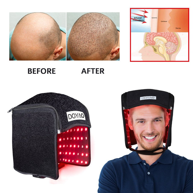 DGYAO Red Light Therapy Cap for Hair Loss Device Infrared Light Portable Foldable Helmet Hair Growth Cap Hair Loss for Men & Women