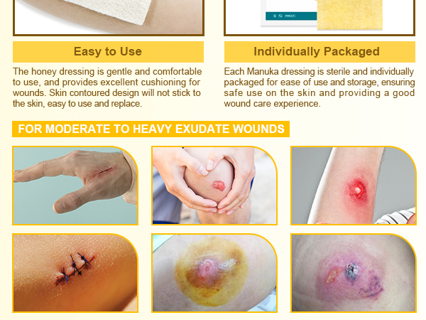 Ceeport Manuka Honey Calcium Alginate Wound Dressing, 2"x 2" High Absorbency Honey Wound Dressing with Calcium Alginate, Medical Grade Manuka Honey Wound Care Bandages Patches for Wounds(Pack of 10)