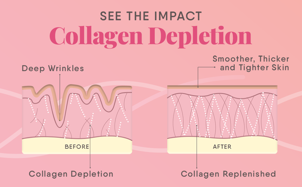 Trunativ Collagen Supplements | Advanced Japanese Marine Collagen Powder for Women & Men | Type 1 and 3 Hydrolyzed Peptides | Supplement with Hyaluronic Acid | Supports Skin Glow, Hair Growth, and Nail Strength | Lychee Coconut (200g)