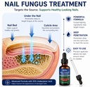 nail-fungus-treatment-25-undecylenic-aci-3.jpg