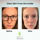 clear-skin-acne-vitamin-system-20-antiox-3.jpg