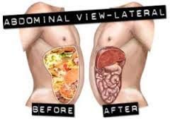 miracle-oxy-colon-cleanse-vegan-colon-cl-2.jpg