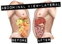 miracle-oxy-colon-cleanse-vegan-colon-cl-2.jpg