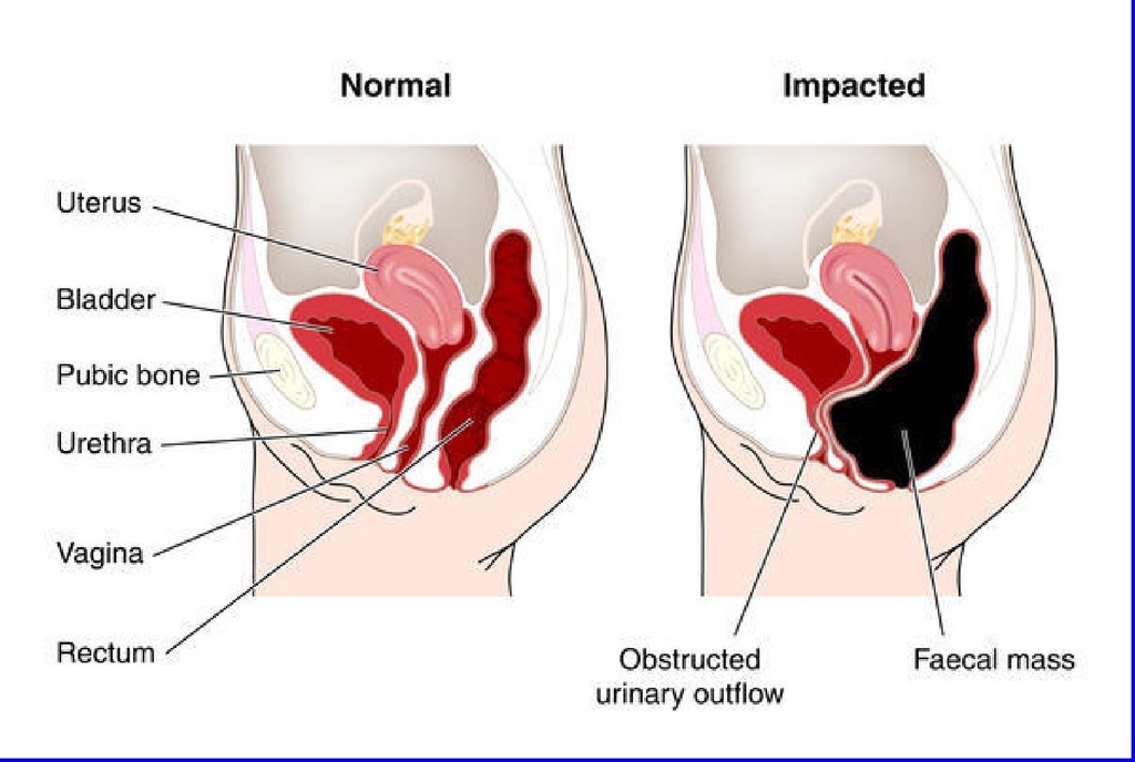 miracle-oxy-colon-2-day-colon-cleanser-a-5.jpg