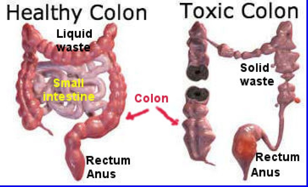 miracle-oxy-colon-2-day-colon-cleanser-a-6.jpg