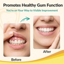 gum-restore-and-gum-repair-for-receding--6.jpg