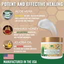 manuka-honey-eczema-cream-moisturizing-l-3.jpg