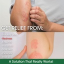 manuka-honey-eczema-cream-moisturizing-l-4.jpg