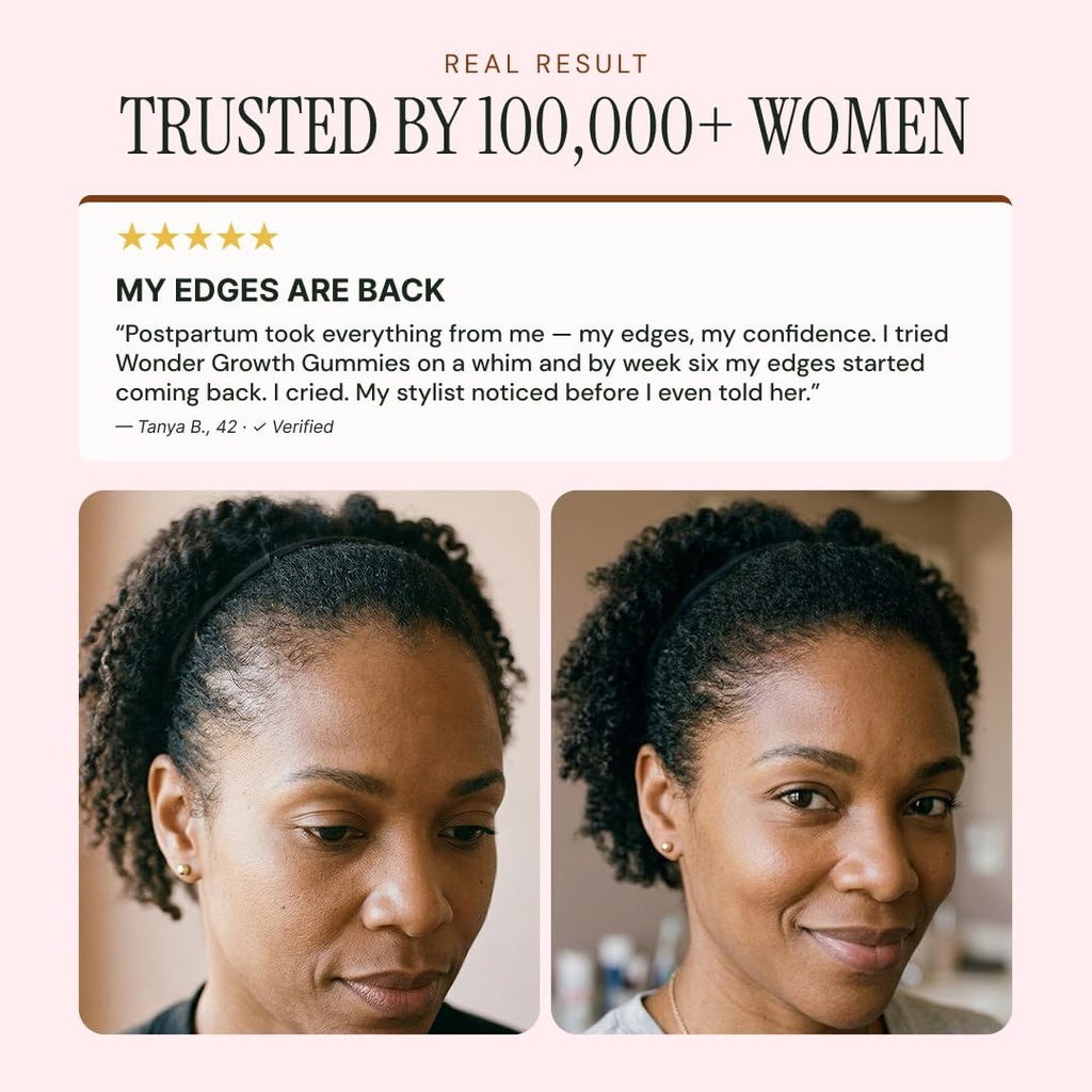 noor-hair-wonder-growth-gummies-for-wome-5.jpg