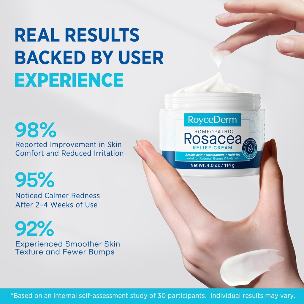 roycederm-rosacea-treatment-for-face-wit-5.jpg