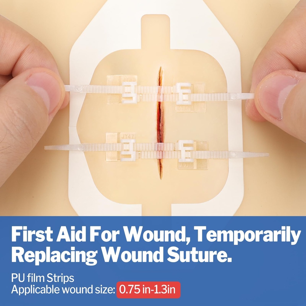 azen-16-pack-wound-closure-strips-4-type-3.jpg