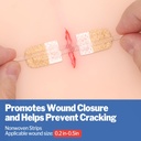 azen-16-pack-wound-closure-strips-4-type-5.jpg