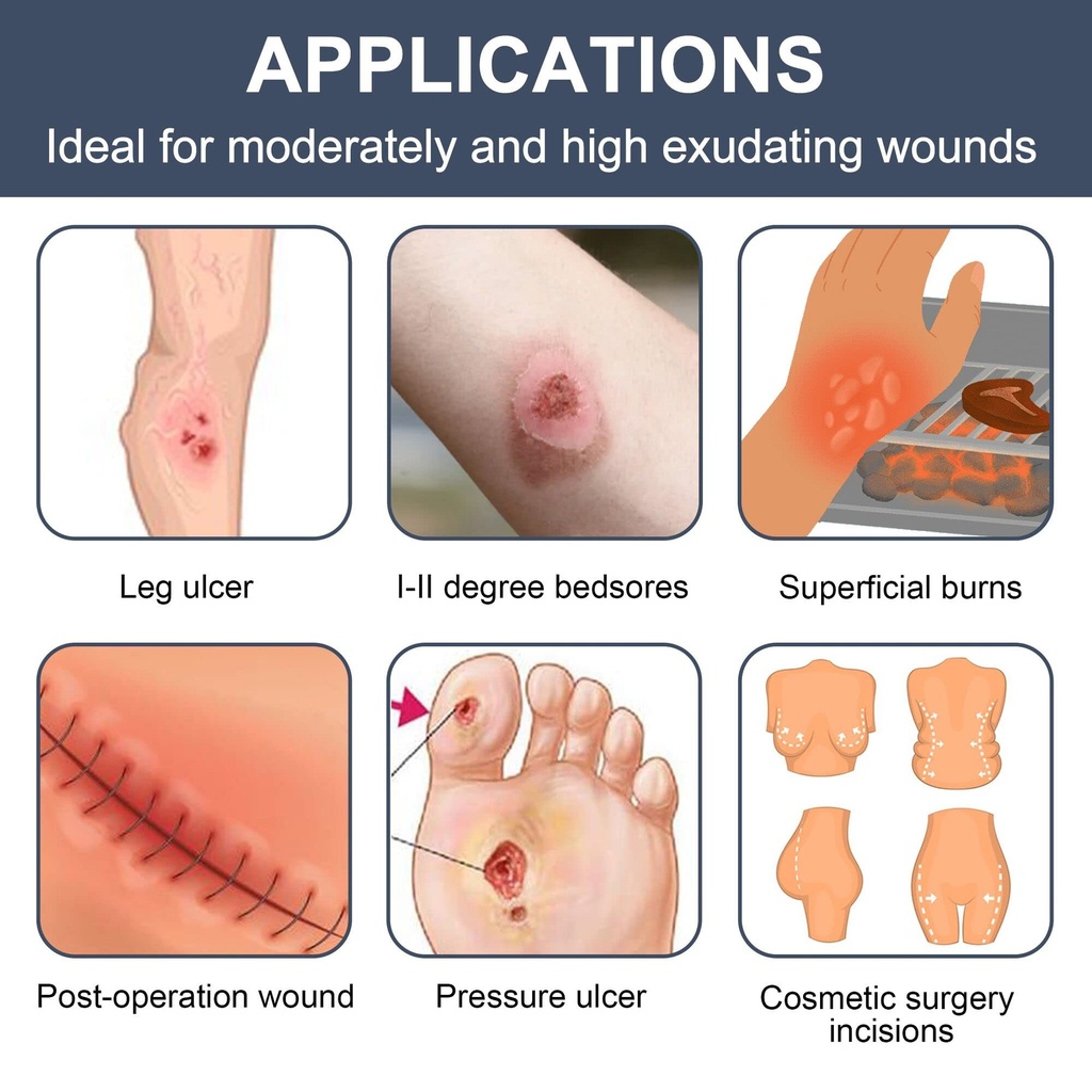 lotfancy-calcium-alginate-wound-dressing-71z7-pWNt9L.jpg