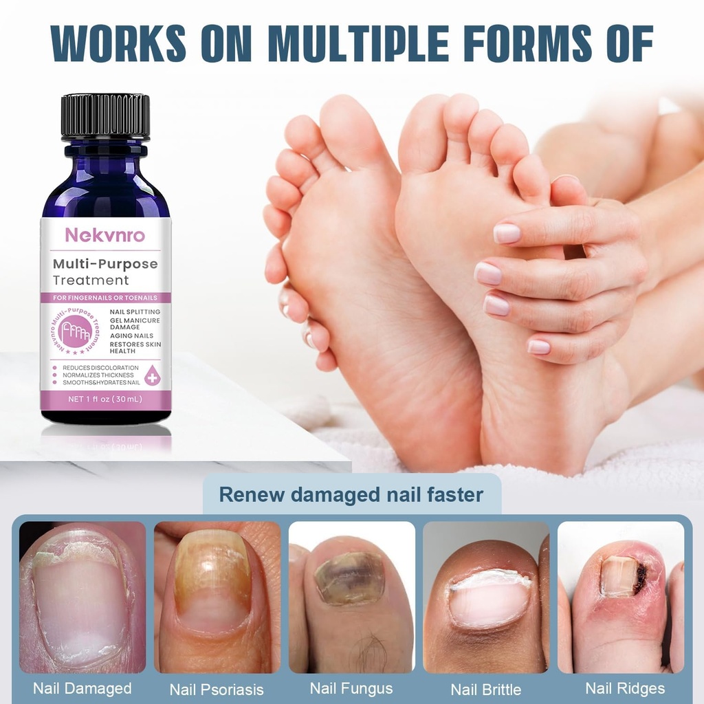extra-strength-nail-fungus-treatment---e-3.jpg