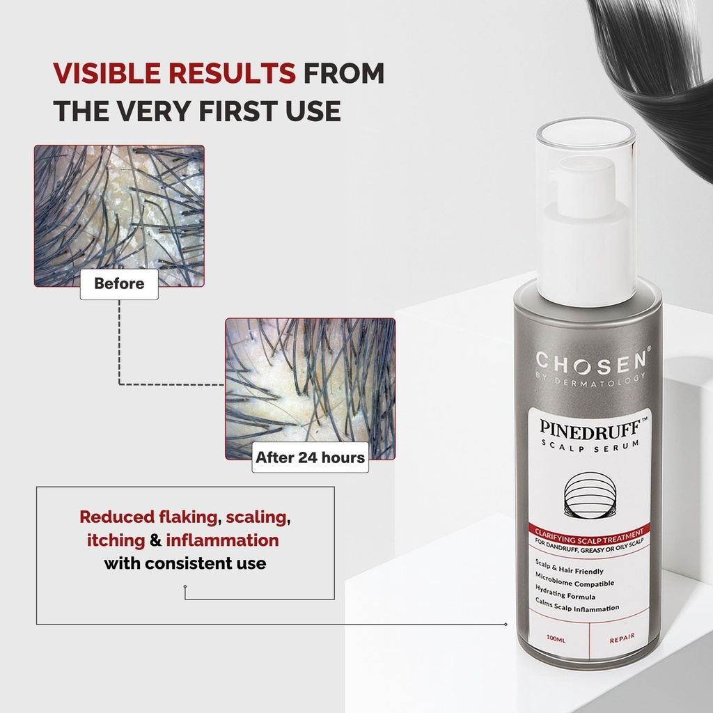 chosen-inside-out-antioxidant-skin-scalp-81mOd39UY7L.jpg