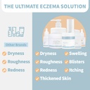 cubed-45-oz-eczema-cream-for-adults-ecze-6.jpg