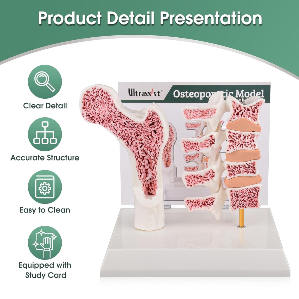 ultrassist-human-anatomy-osteoporosis-mo-2.jpg