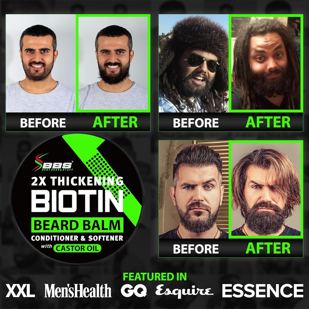 beard-growth-kit-wgrow-xxl-beard-oilseru-6.jpg