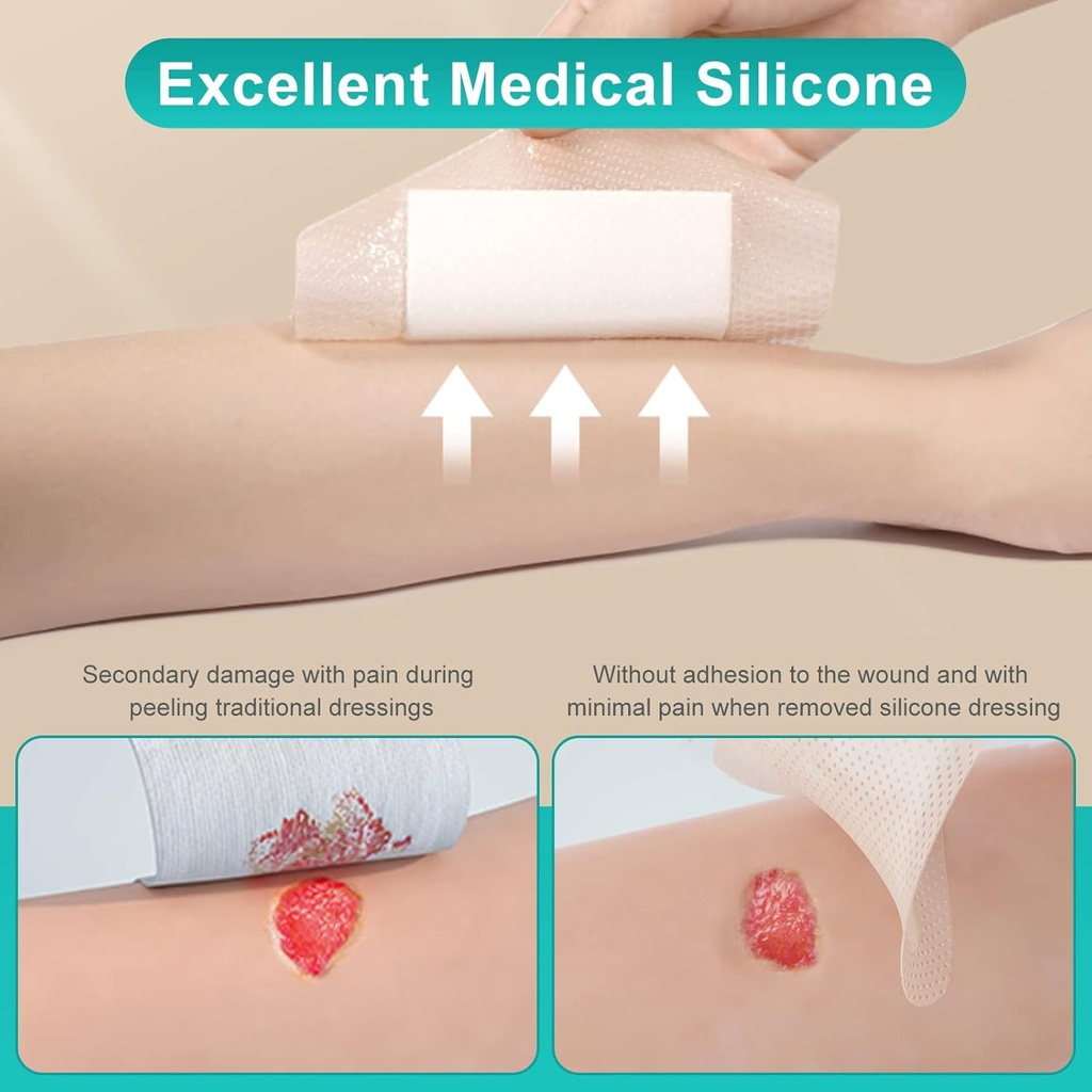 dimora-silicone-foam-dressing-with-borde-4.jpg
