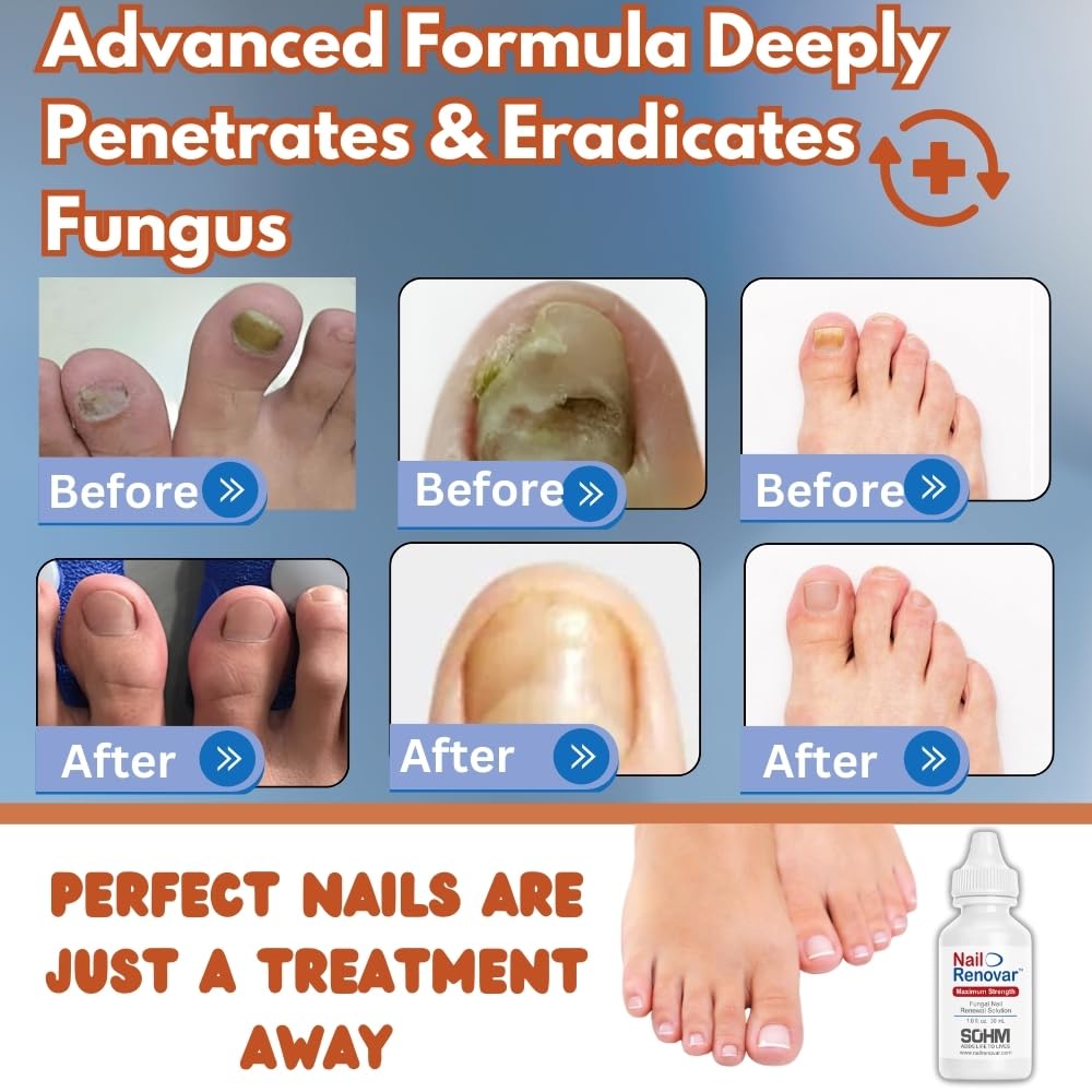 toenail-fungus-treatment-extra-strength--2.jpg