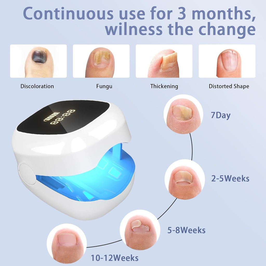 nail-fungus-laser-treatment-led-light-de-4.jpg