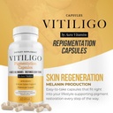 dermawonder-vitiligo-capsules-60-count-e-3.jpg