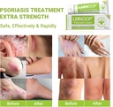 psoriasis-cream-maximum-strength-treatme-5.jpg