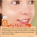 l-lysine-gummies-1000mg---l-lysine-suppl-4.jpg