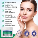 hermon-psoriasis-eczema-relief-cream-max-6.jpg